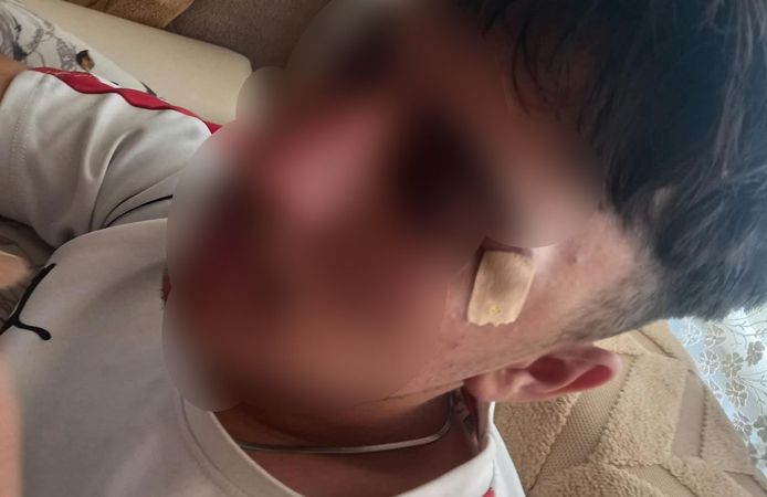 Öğrenci yaralandı, öğretmen hakkında soruşturma