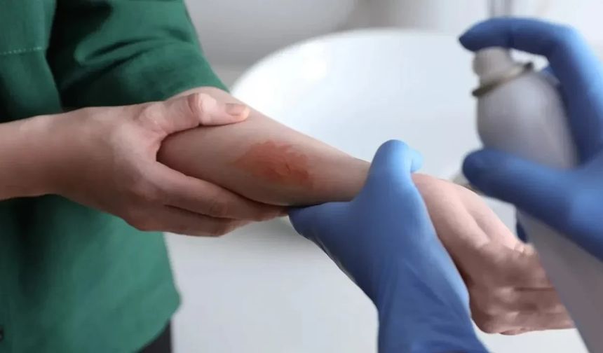 Kanamayı saniyeler içinde durduran sprey: Bilim insanlarından kritik buluş