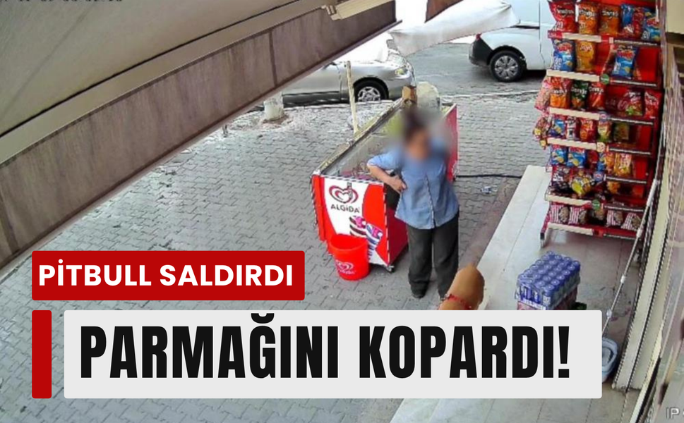 Pitbull saldırdı, parmağını kopardı!