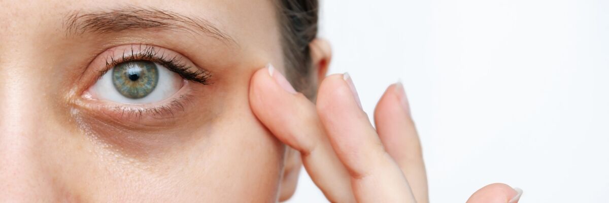 Goz Alti Morluklari 55328 B