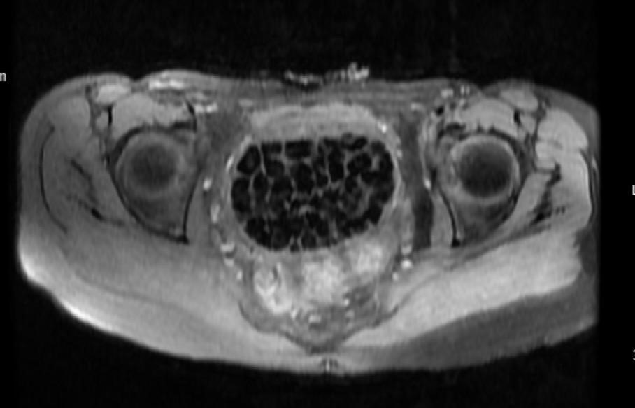 A W542492 08