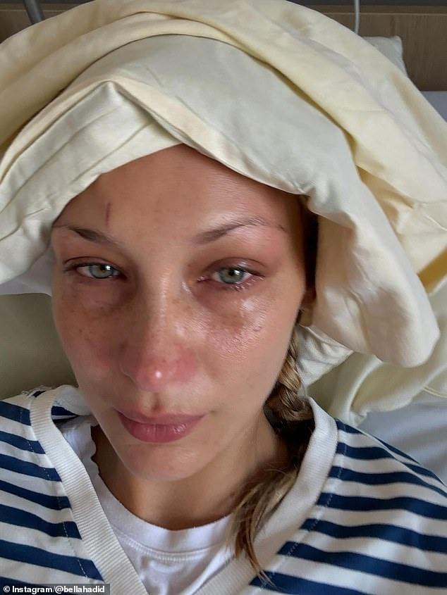 Bella Hadid Den Korkutan Paylasim Hastane 19059737 1683 M
