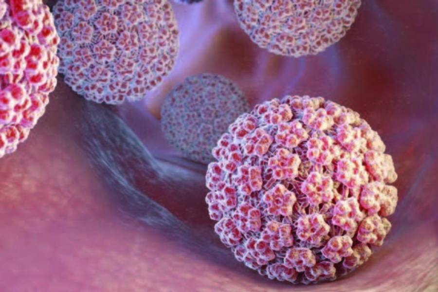 Hpv Human Papilloma Virus Resim 926086 W900 H600
