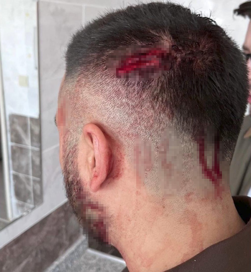 Şanlıurfa’da Öğretmen, Öğrenci Velisi Tarafından Sopayla Darbedildi (1)-1