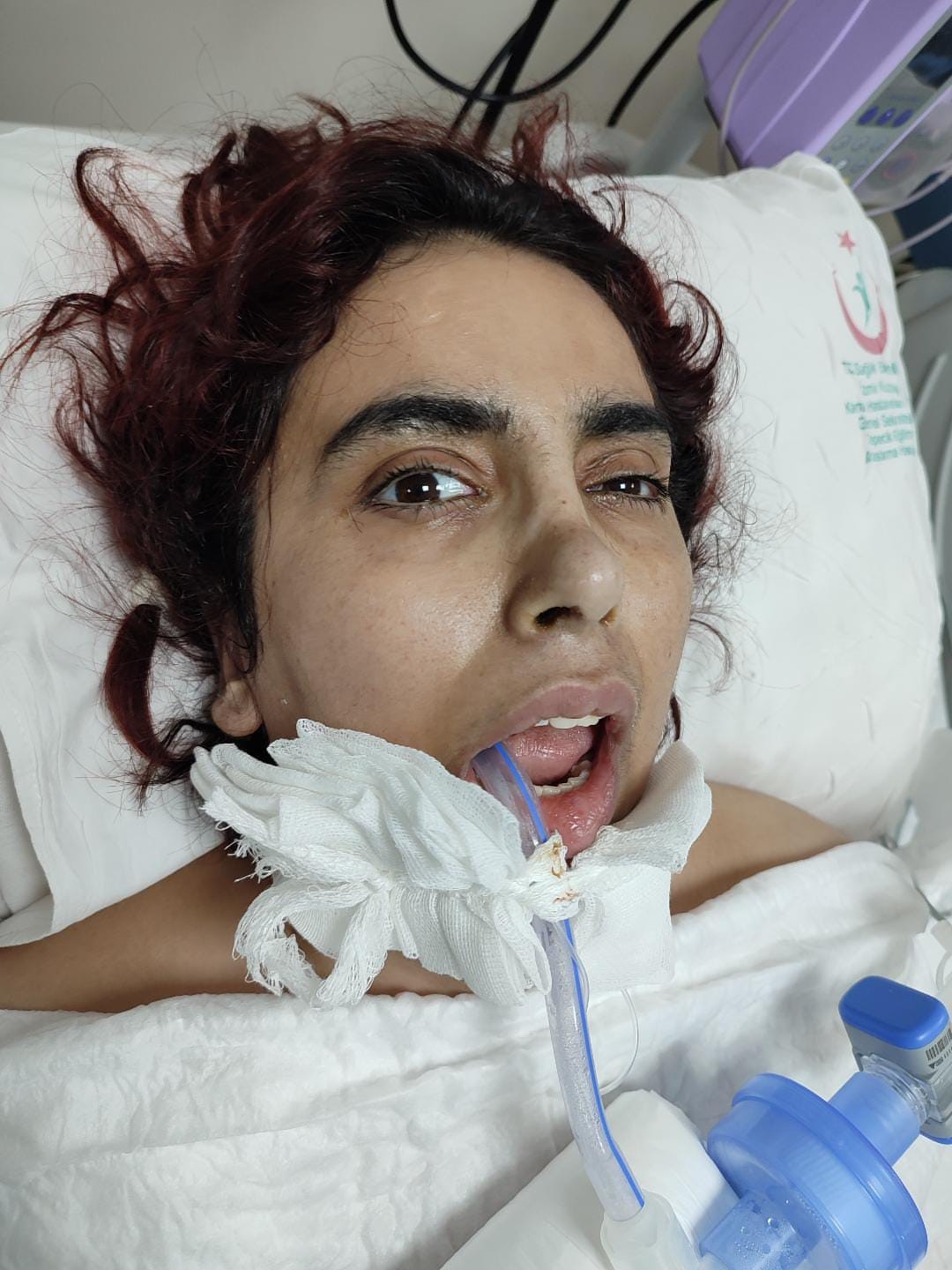 45 Gün Komada Kaldı, 'Yaşayamaz' Dediler İzmirli Anne Yeniden Yürüdü (2)