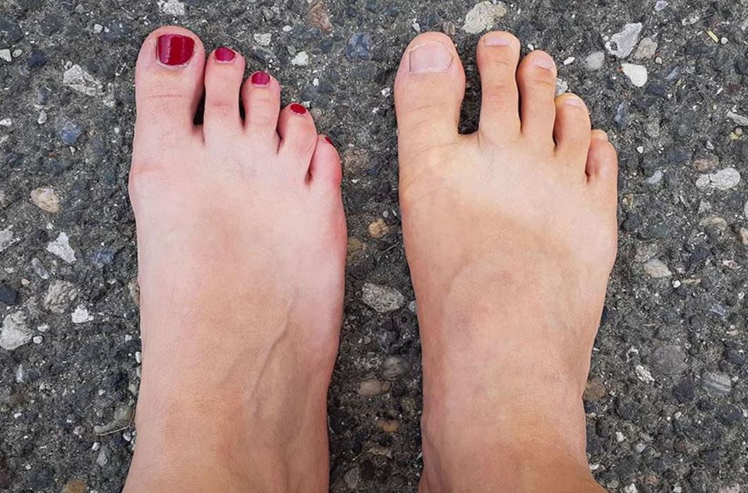 Ayak Şekliniz Karakterinizi Ele Veriyor! Hangi Tipe Sahipsiniz (4)