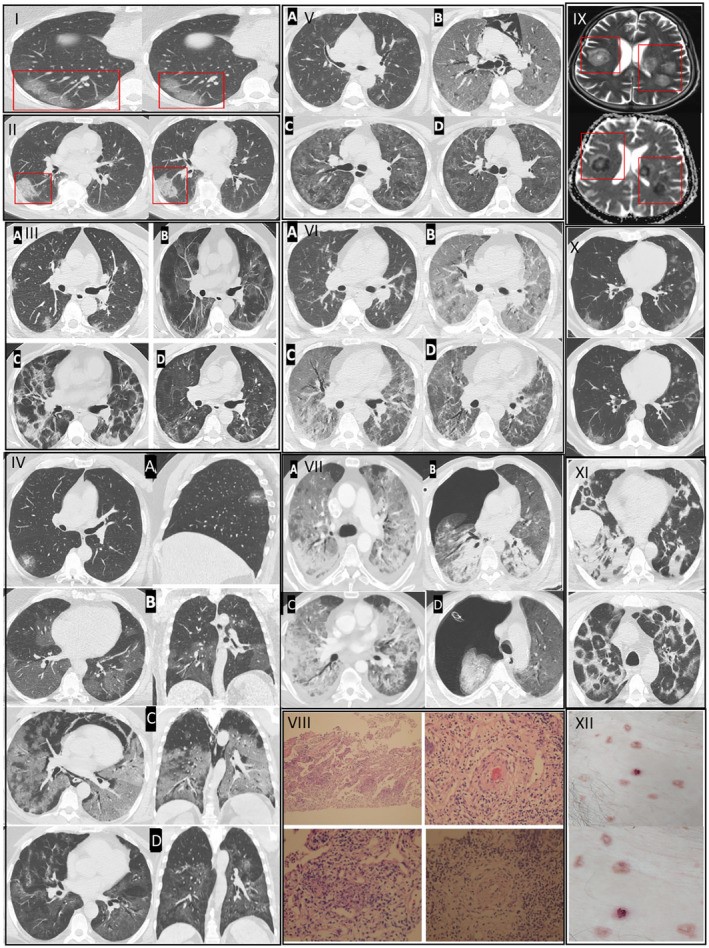 Gençlerde Ani Ölümler Artıyor (1)
