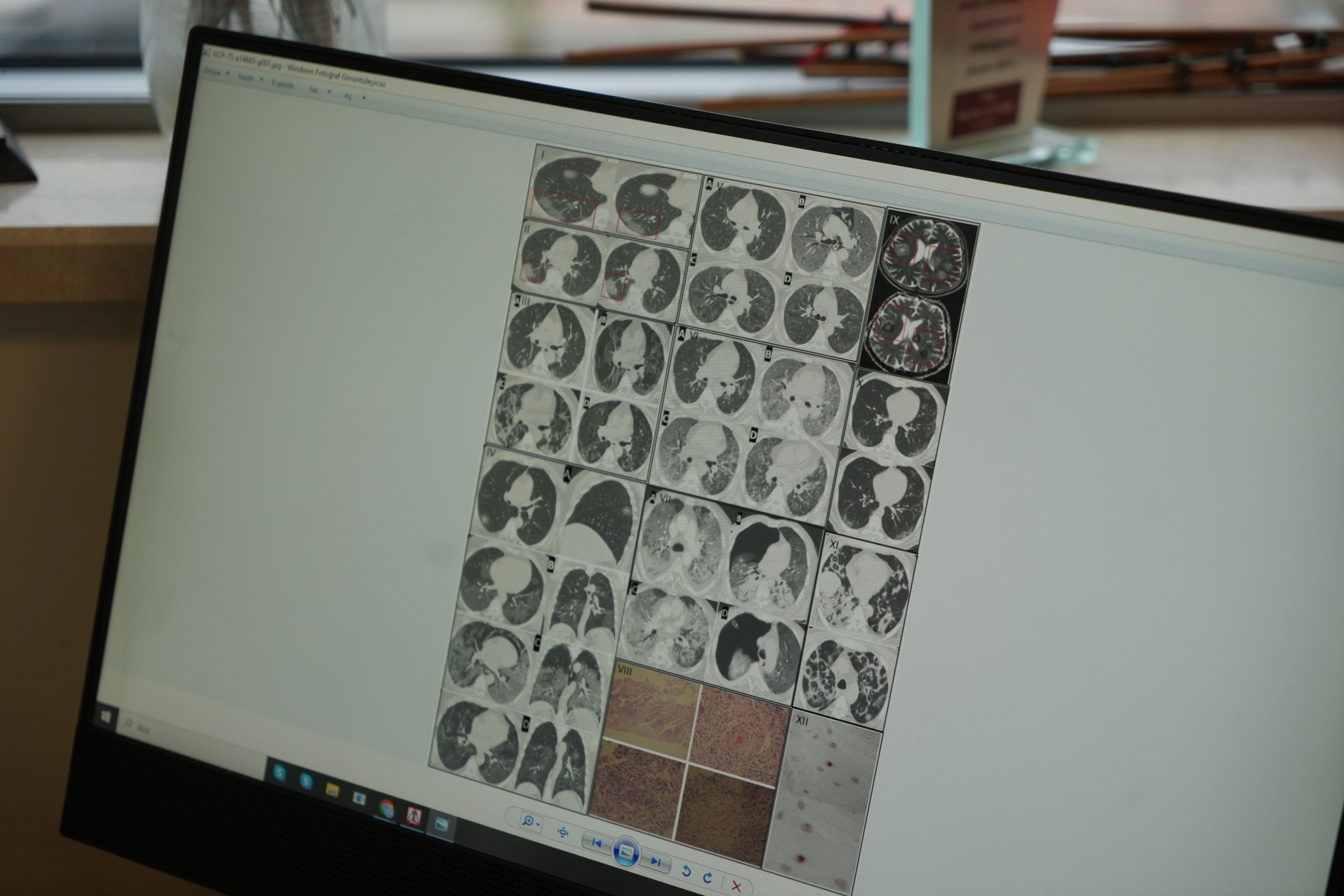 Gençlerde Ani Ölümler Artıyor (2)