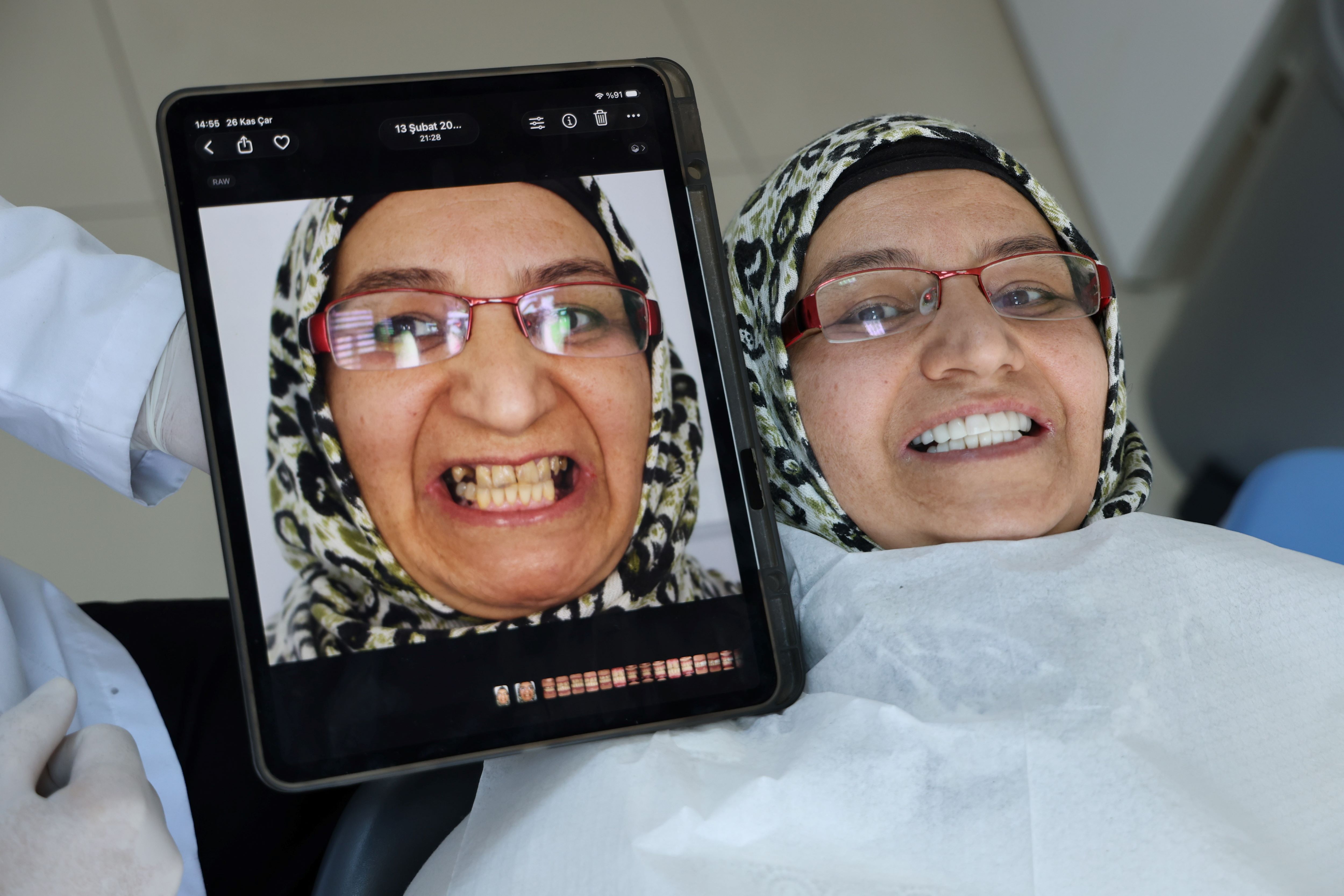 İmplantlar Tarihe Mi Karışıyor (2)