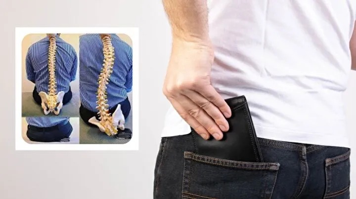 Arka Cepte Cüzdan Taşıyanlar Dikkat! Omurganızı Sessizce Çökertiyor (2)