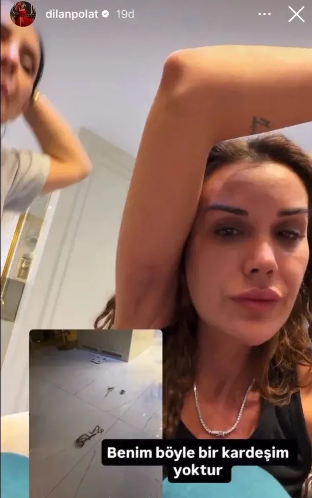 Dilan Polat'ı Tekme Tokat Dövdü! Darp Görüntülerini Paylaştı (2)