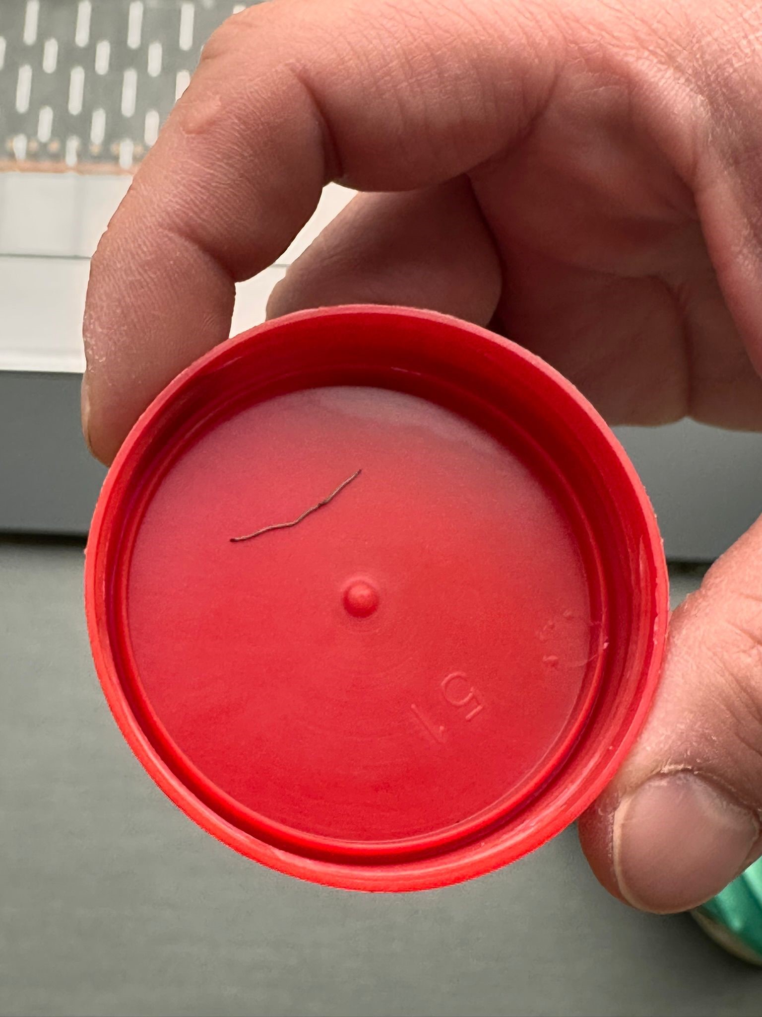 Kan Donduran Olay! Bebeğin Sırtından Tel Parçası Çıktı (2)