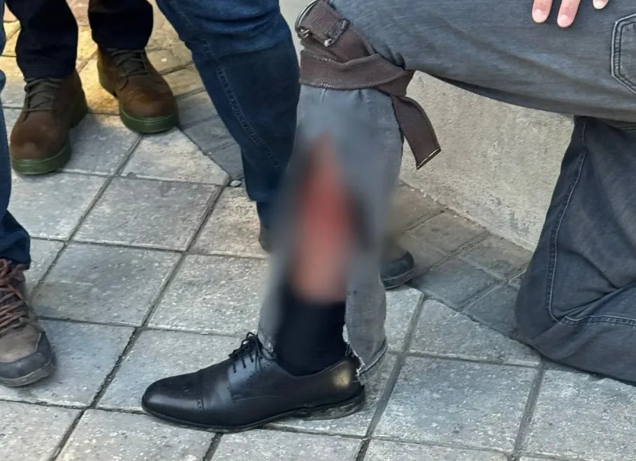 Parti Il Başkanından Internet Haber Sitesi Sahibine Silahlı Saldırı! (2)