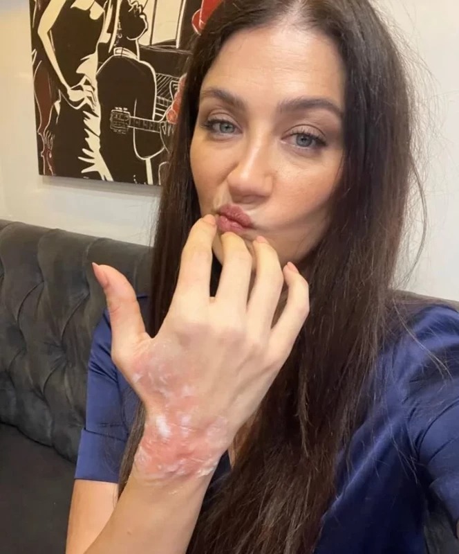 Ceren Benderlioglu Kaza 1