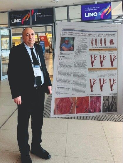 İzmirli Kalp Damar Cerrahı Doç. Dr. Necmettin Yakut Ve Ekibi, Şah Damarlarında Ciddi Darlık Ve Tıkanıklıkların Tedavisinde Uyguladıkları Yeni Cerrahi Yöntemle Uluslararası Tıp Dünyasının Dikkatini Çekti (2)