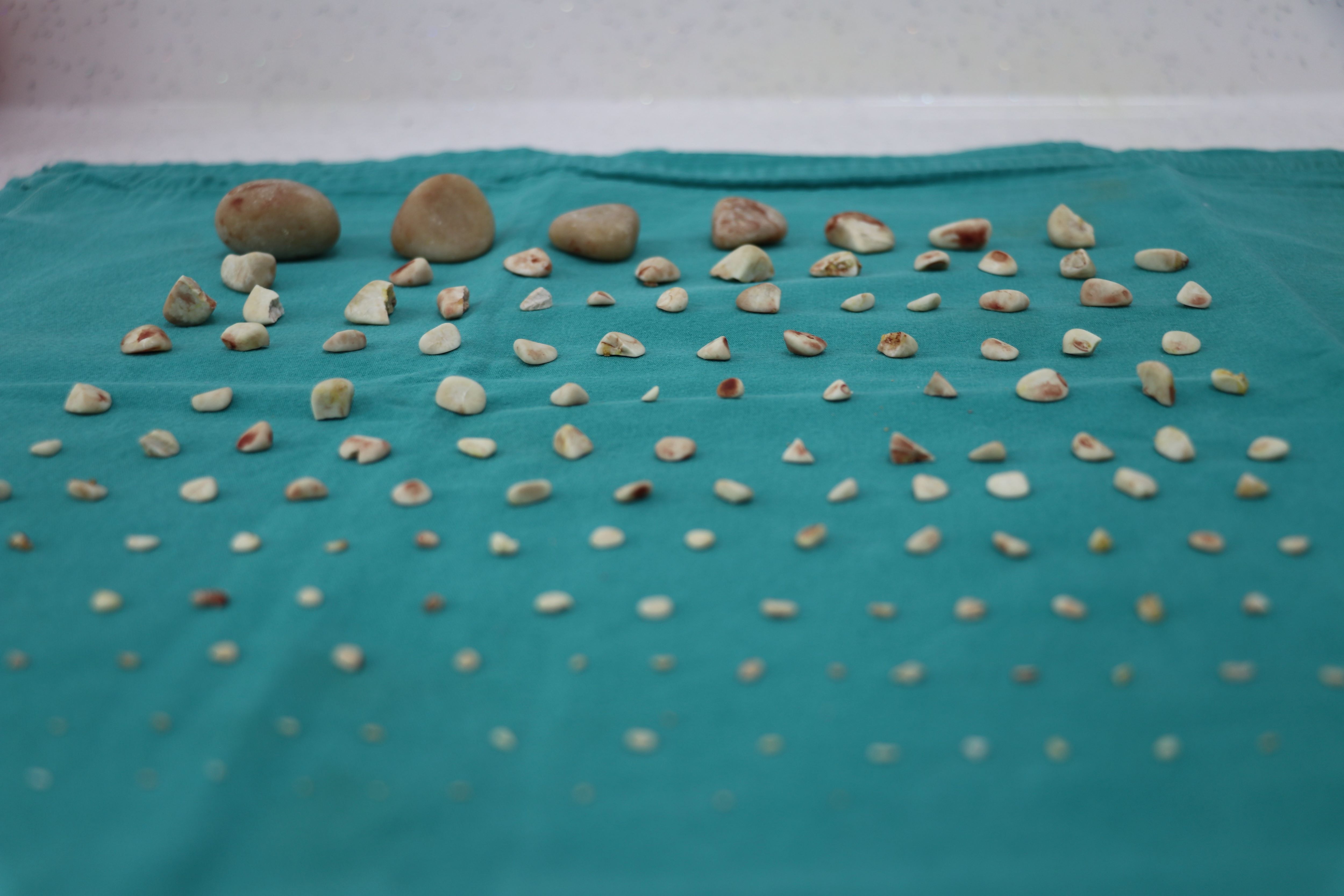 Şaşırtan Operasyon Köpeğin Karnından 140 Taş Çıkarıldı (1)