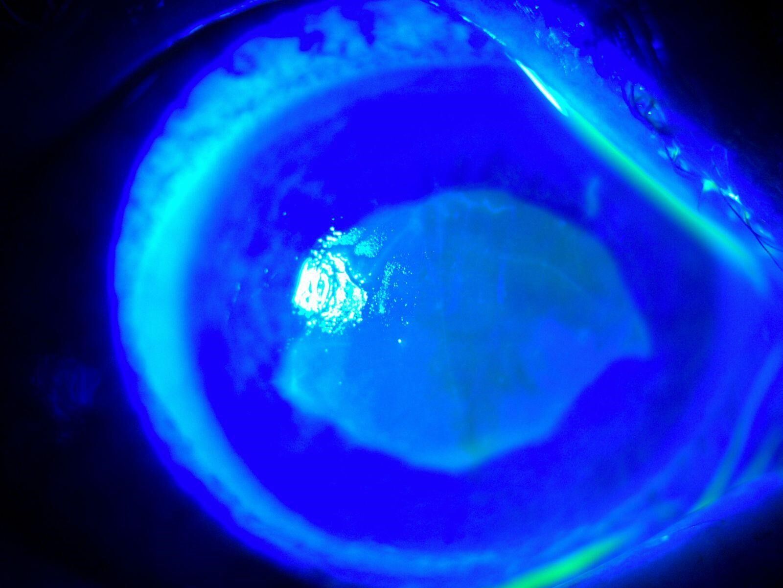 Göz Sağlığında Tehlikeli Trend Kırlangıç Otu Uyarısı (1)