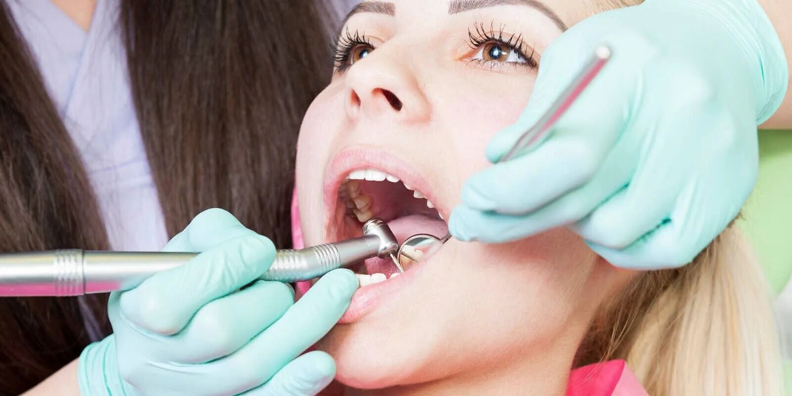 Diş taşlarını evde temizlemenin doğal yolları: Tartar oluşumu nasıl engellenir?-1