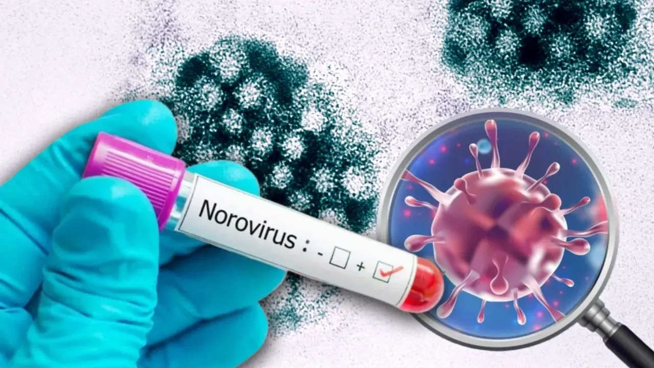 Norovirüs2
