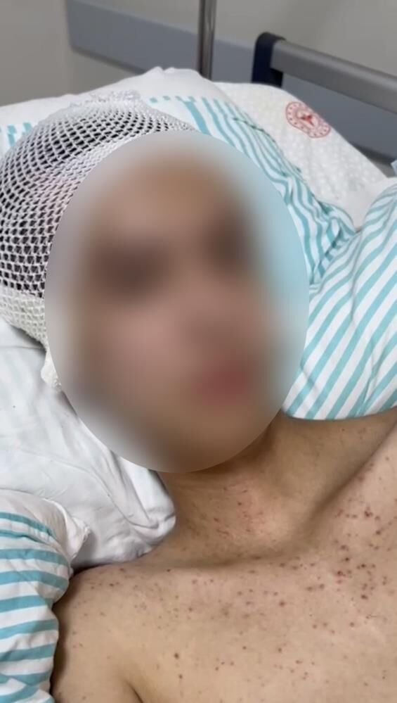 Komanın Ardından Gelen Itiraf Serbest Kalan Şüpheli Tutuklandı! (1)