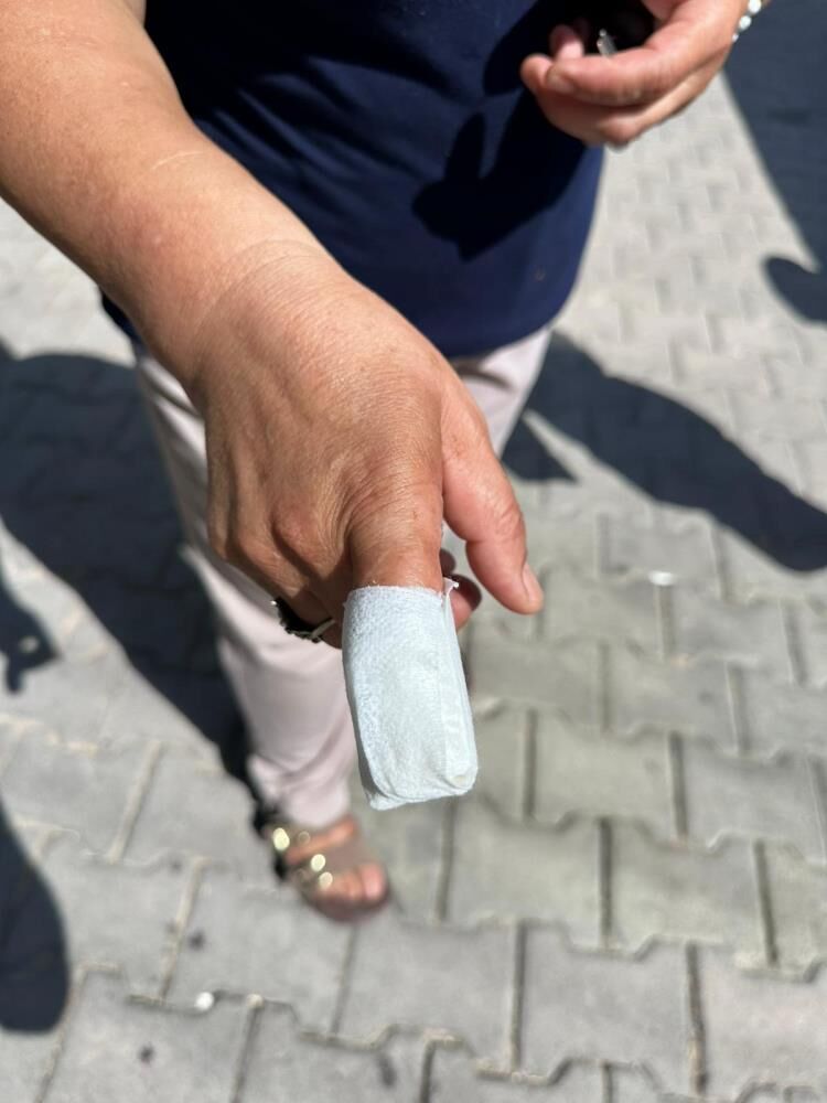 Pitbull Saldırdı (4)