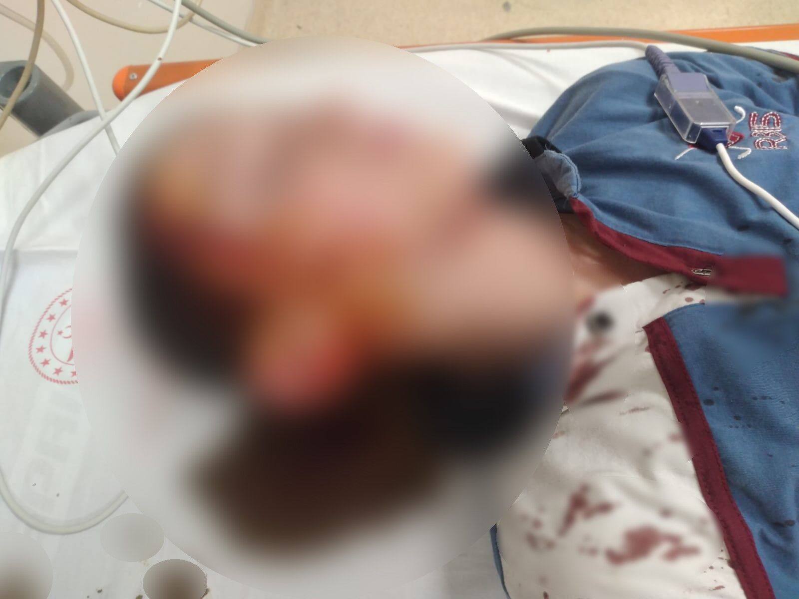 İzmir Menderes’te köpek saldırısında yüzünden yaralanan 11 yaşındaki çocuk için açılan tazminat davasında mahkeme, aileye toplam 1 milyon 200 bin 249 lira ödenmesine karar verdi.
